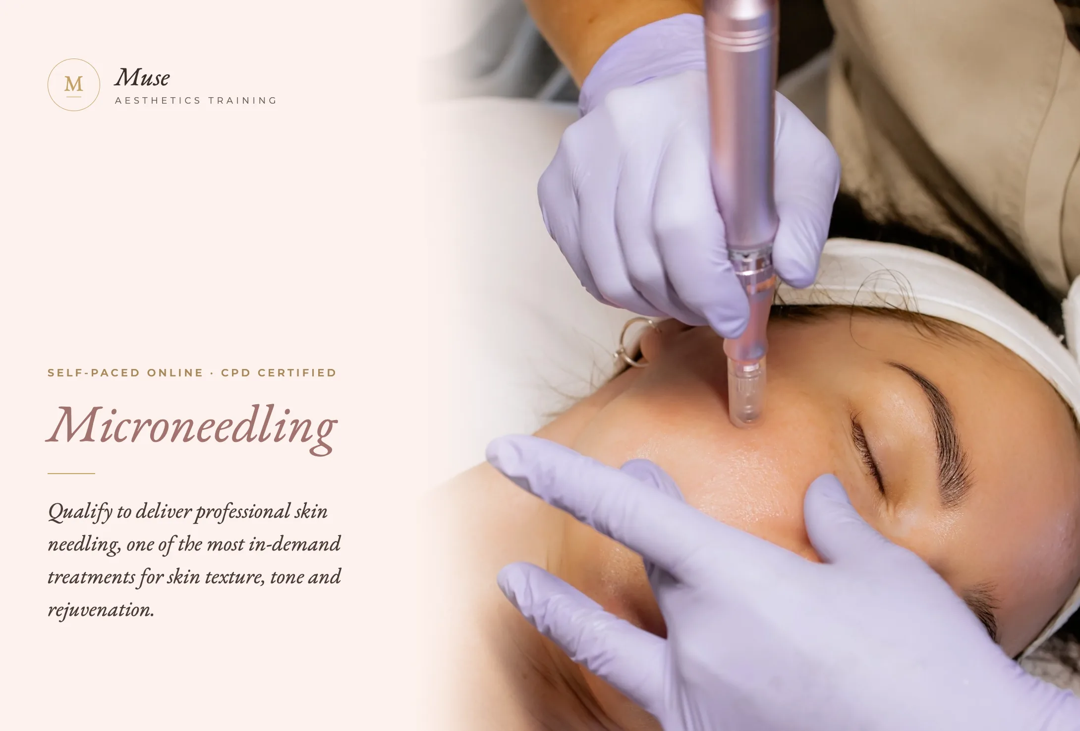 Microneedling